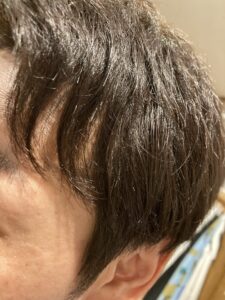 くせ毛,縮毛矯正,酸性ストレート